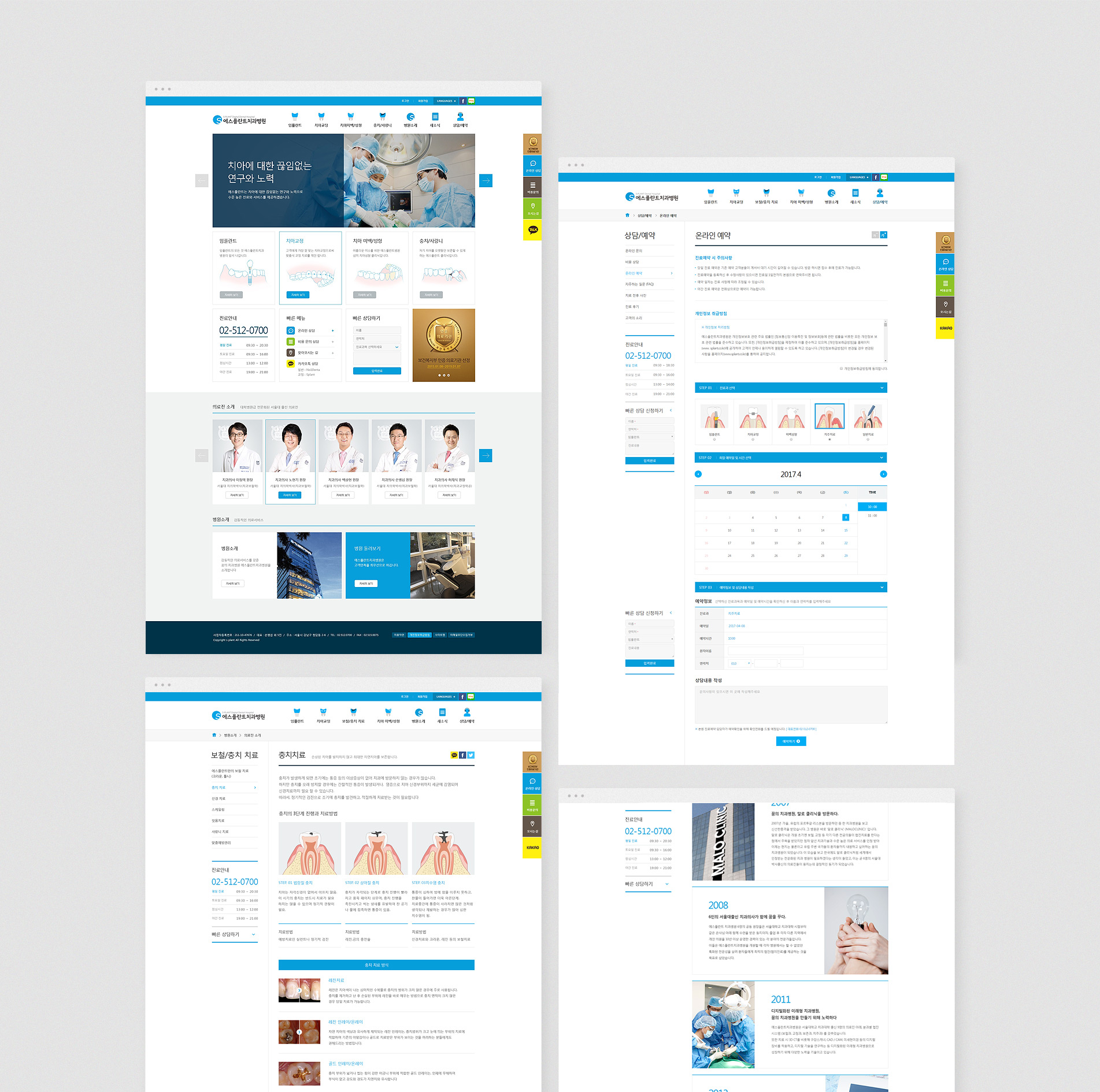 에스플란트 캡쳐