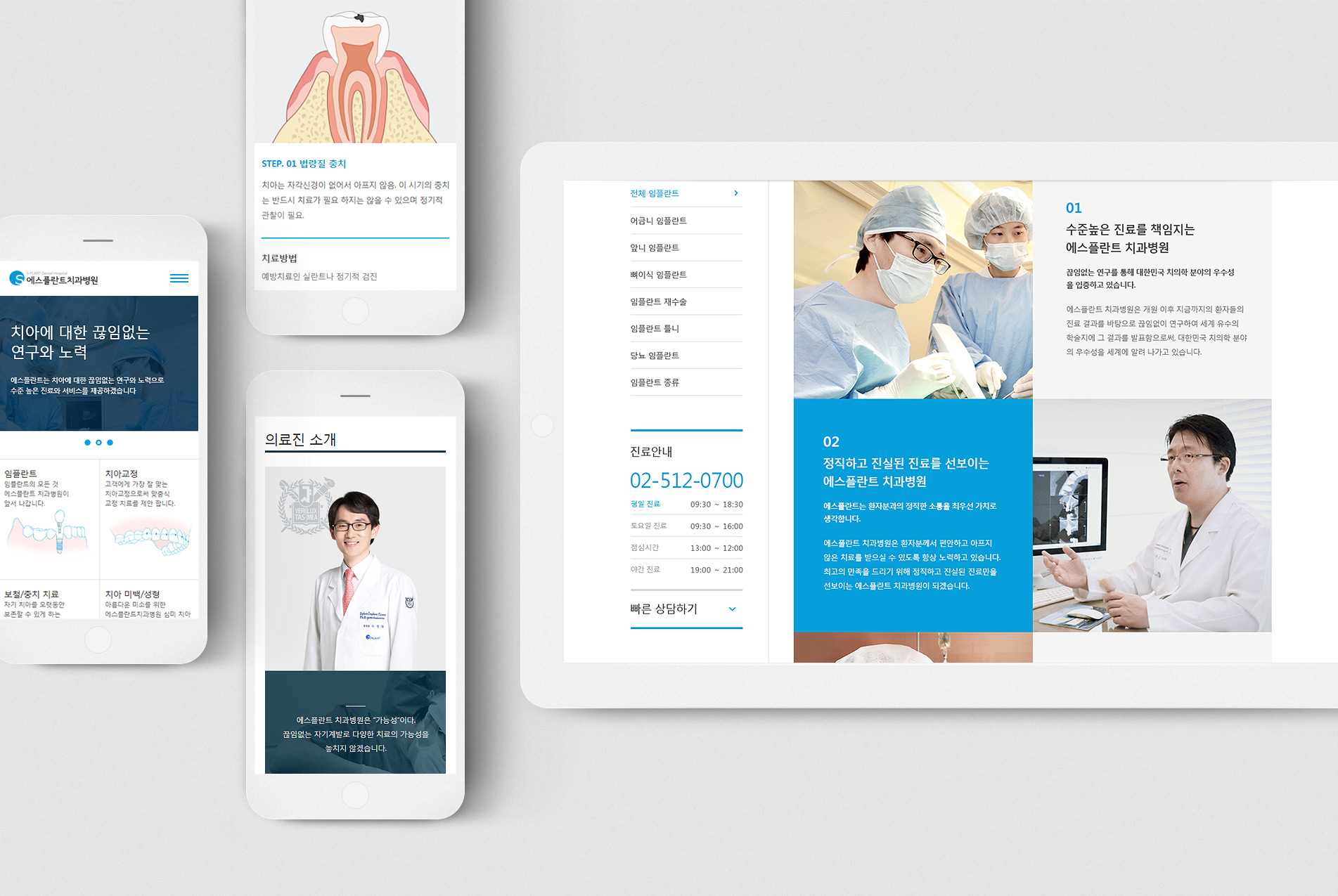 에스플란트 디스플레이